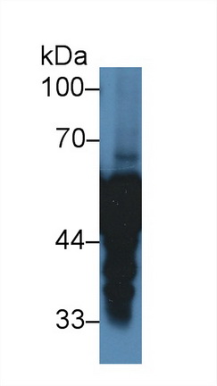 Polyclonal Antibody to Alpha-2-Heremans Schmid Glycoprotein (AHSG)