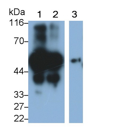 Polyclonal Antibody to Alpha-2-Heremans Schmid Glycoprotein (AHSG)