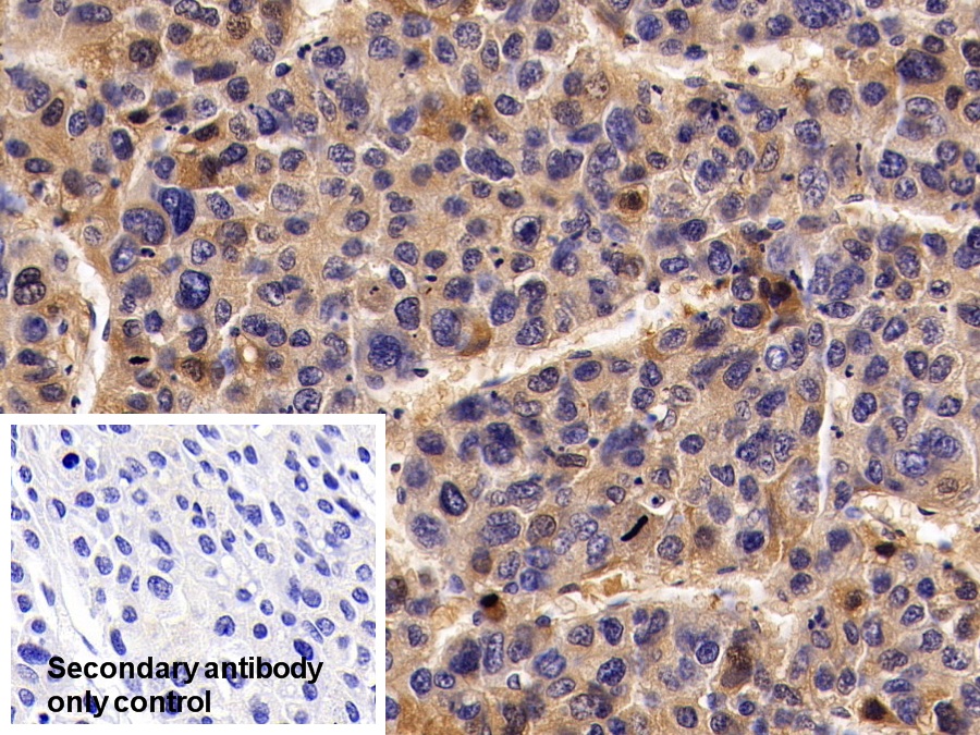 Polyclonal Antibody to Alpha-2-Heremans Schmid Glycoprotein (AHSG)