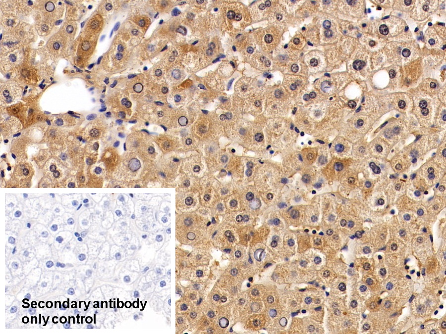 Polyclonal Antibody to Alpha-2-Heremans Schmid Glycoprotein (AHSG)