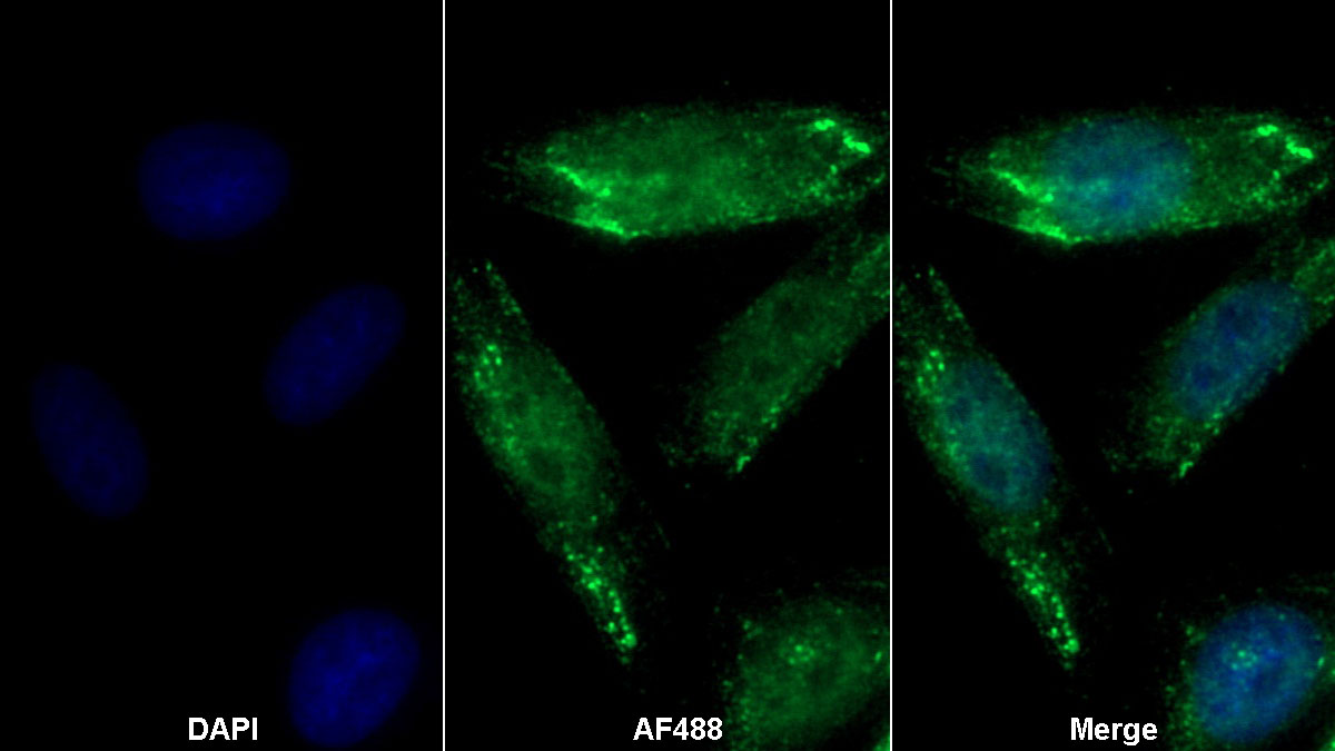 Polyclonal Antibody to Alpha-2-Heremans Schmid Glycoprotein (AHSG)