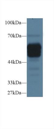 Polyclonal Antibody to Alpha-2-Heremans Schmid Glycoprotein (AHSG)