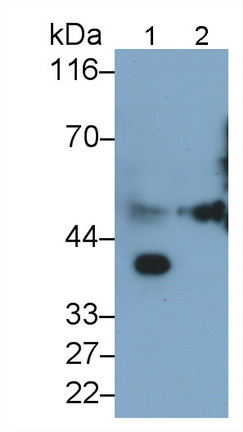 Polyclonal Antibody to Alpha-2-Heremans Schmid Glycoprotein (AHSG)