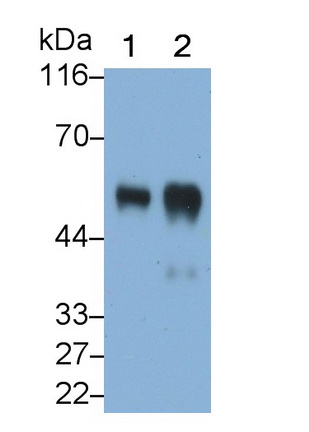 Polyclonal Antibody to Alpha-2-Heremans Schmid Glycoprotein (AHSG)