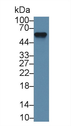 Polyclonal Antibody to Alpha-2-Heremans Schmid Glycoprotein (AHSG)