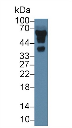 Polyclonal Antibody to Alpha-2-Heremans Schmid Glycoprotein (AHSG)