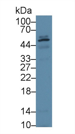 Polyclonal Antibody to Alpha-2-Heremans Schmid Glycoprotein (AHSG)