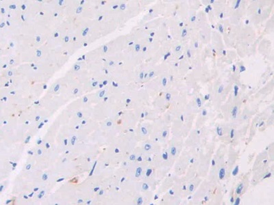 Polyclonal Antibody to Alpha-2-Heremans Schmid Glycoprotein (AHSG)