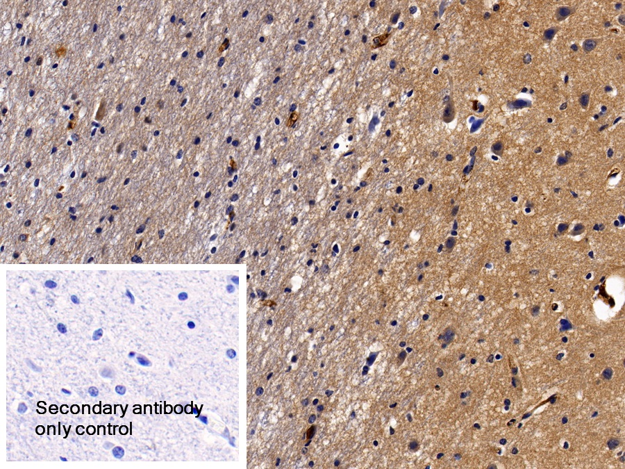 Polyclonal Antibody to Alpha-2-Heremans Schmid Glycoprotein (AHSG)