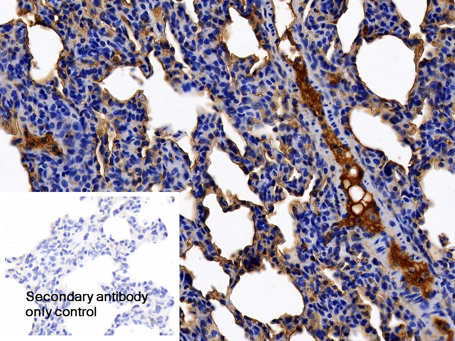 Polyclonal Antibody to Alpha-2-Heremans Schmid Glycoprotein (AHSG)