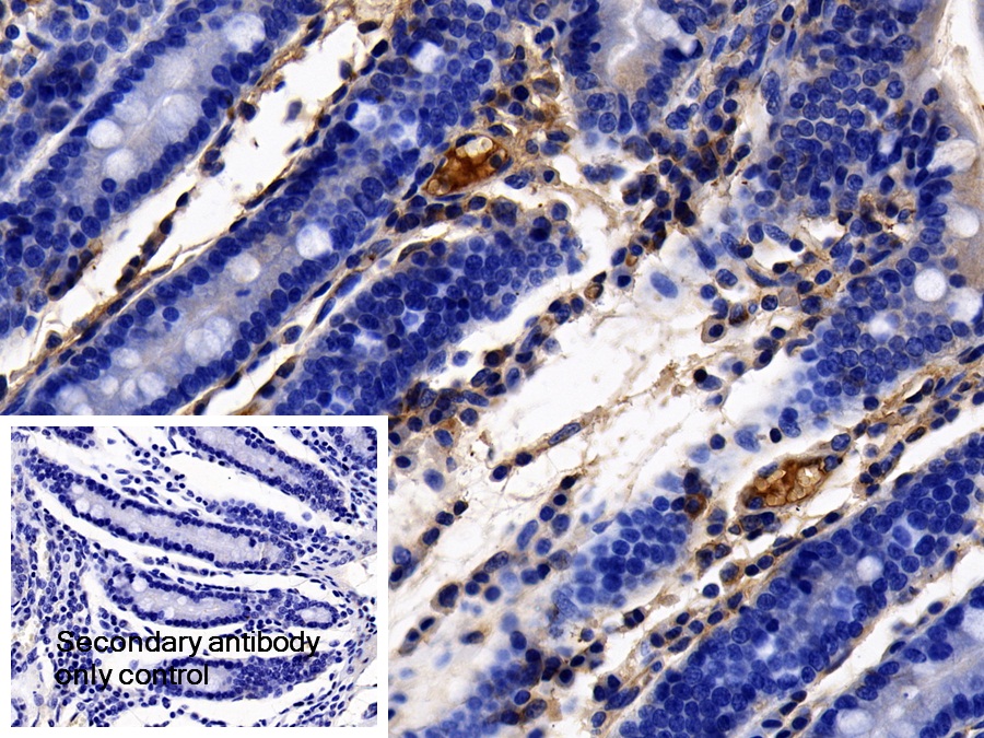 Polyclonal Antibody to Alpha-2-Heremans Schmid Glycoprotein (AHSG)