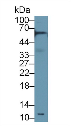 Polyclonal Antibody to Alpha-2-Heremans Schmid Glycoprotein (AHSG)