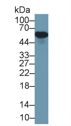 Polyclonal Antibody to Alpha-2-Heremans Schmid Glycoprotein (AHSG)