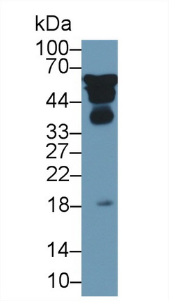 Polyclonal Antibody to Alpha-2-Heremans Schmid Glycoprotein (AHSG)