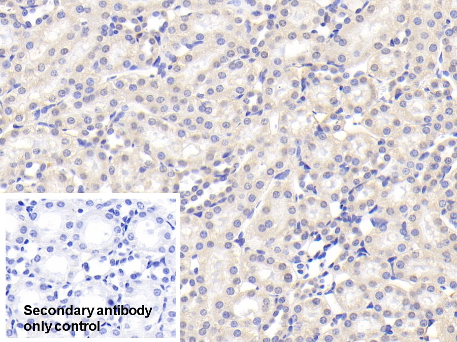 Polyclonal Antibody to Alpha-2-Heremans Schmid Glycoprotein (AHSG)