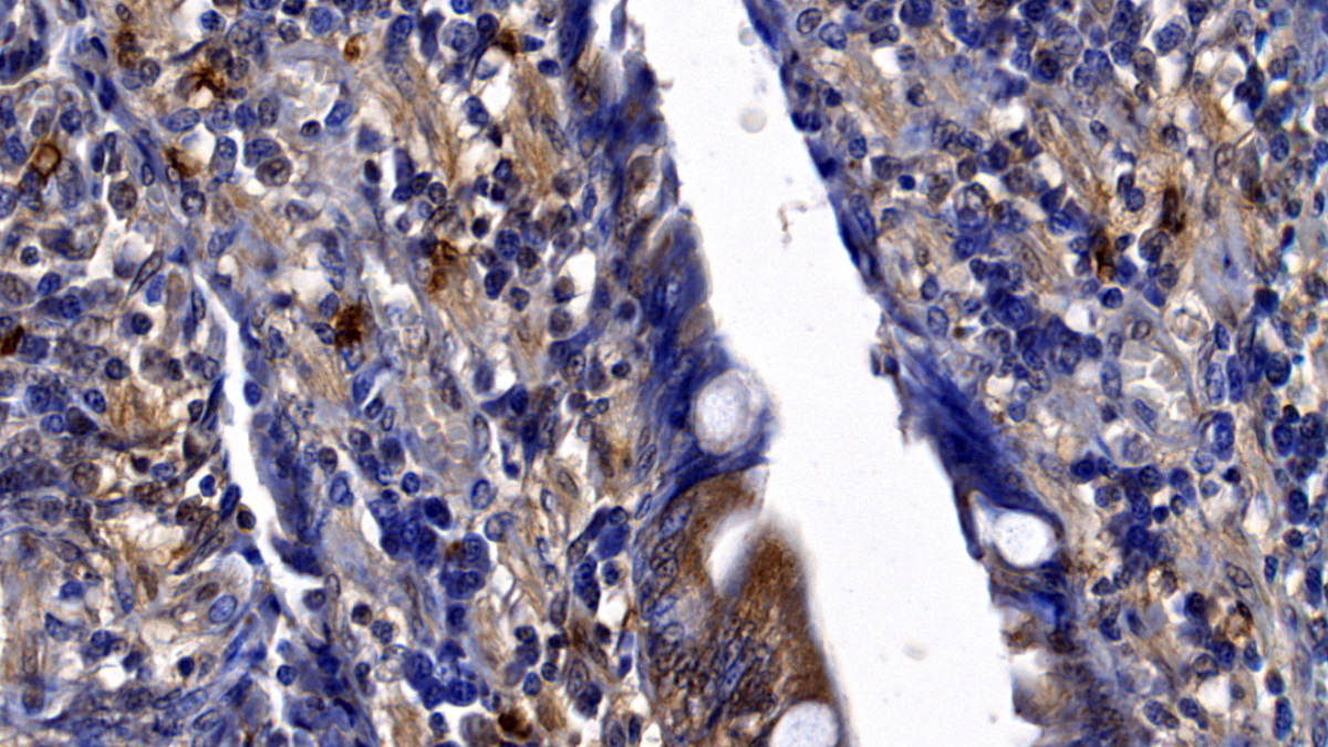 Polyclonal Antibody to Neutrophil Elastase (NE)