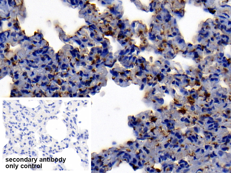 Polyclonal Antibody to Neutrophil Elastase (NE)