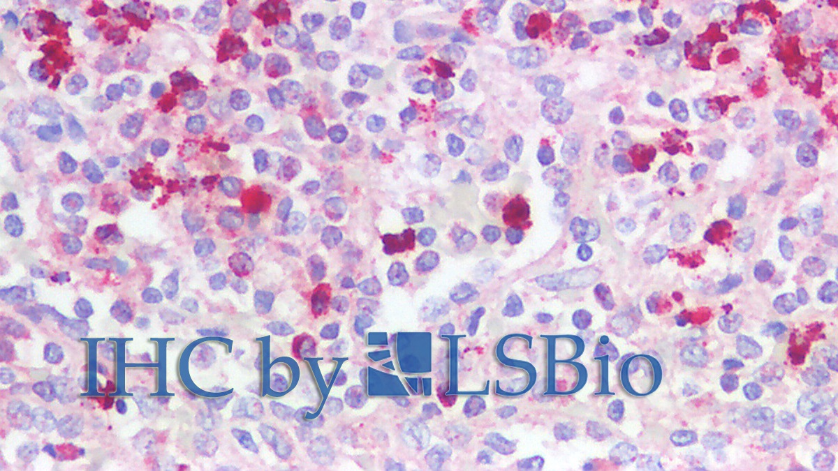 Polyclonal Antibody to Neutrophil Elastase (NE)