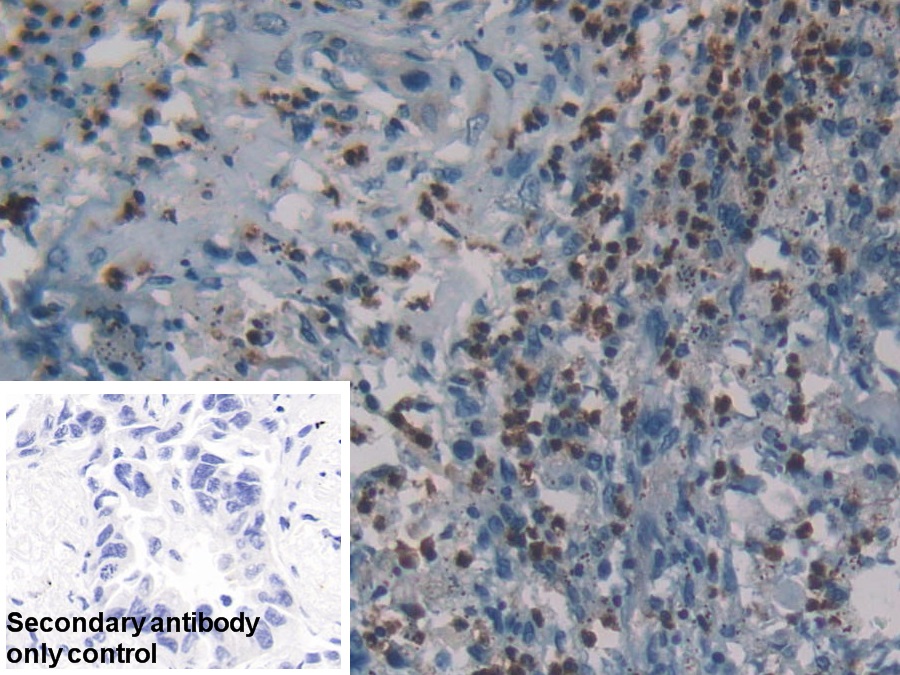 Polyclonal Antibody to Neutrophil Elastase (NE)