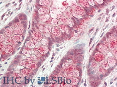 Polyclonal Antibody to Galactosidase Alpha (GLa)