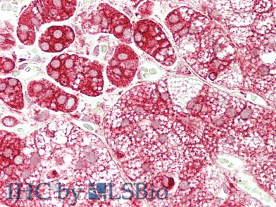 Polyclonal Antibody to Galactosidase Alpha (GLa)