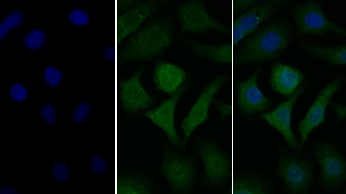 Polyclonal Antibody to Galactosidase Alpha (GLa)