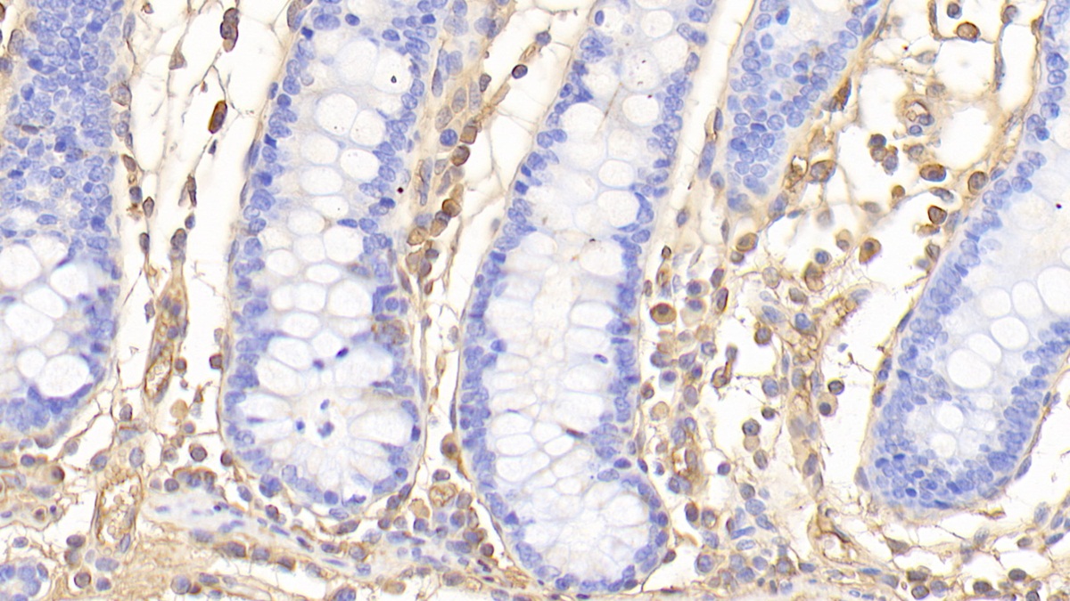 Polyclonal Antibody to Glycated Hemoglobin A1c (HbA1c)