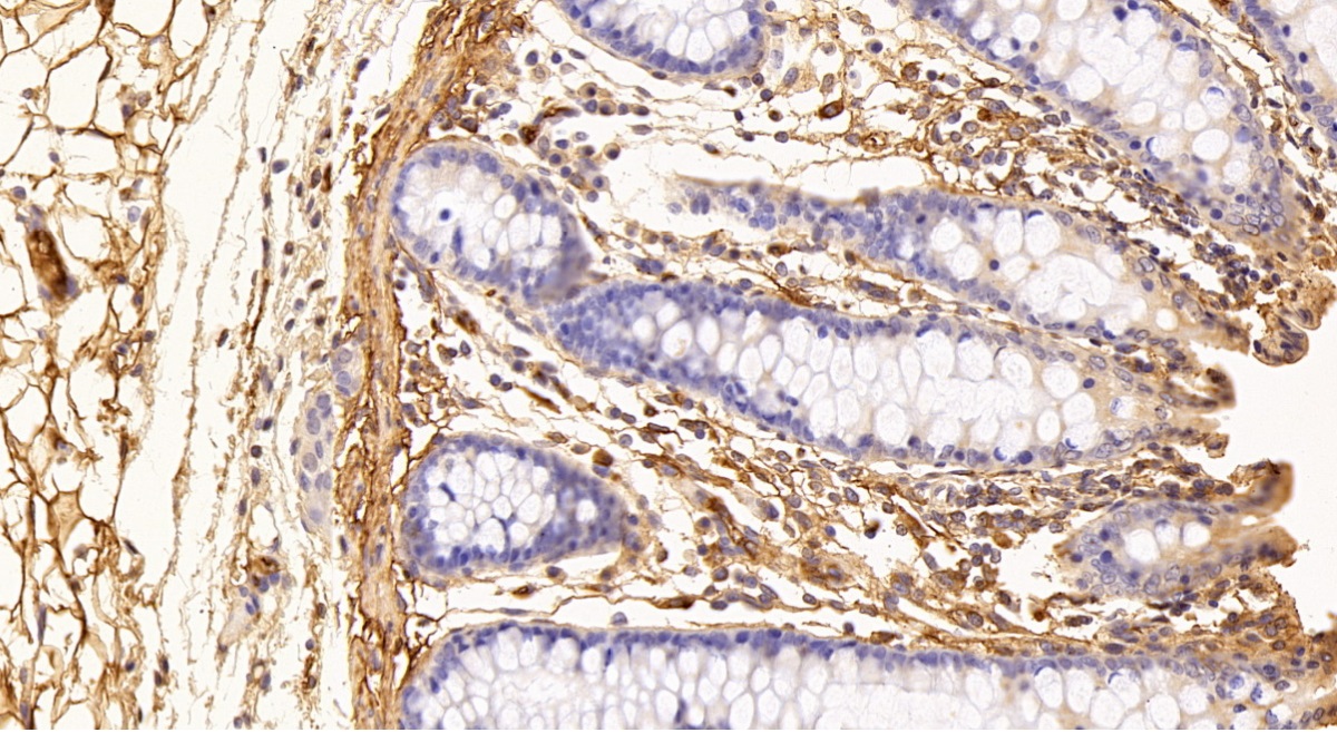 Polyclonal Antibody to Fibrinogen (FG)