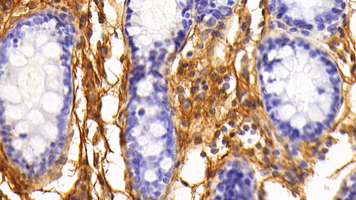 Polyclonal Antibody to Fibrinogen (FG)