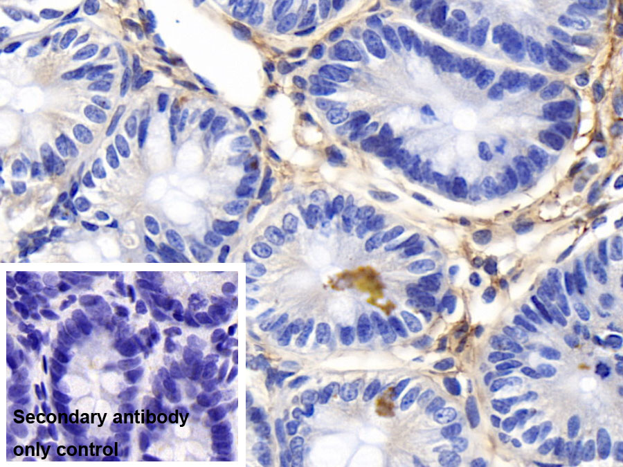 Polyclonal Antibody to Fibrinogen (FG)