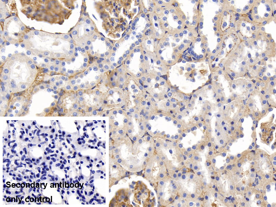 Polyclonal Antibody to Fibrinogen (FG)