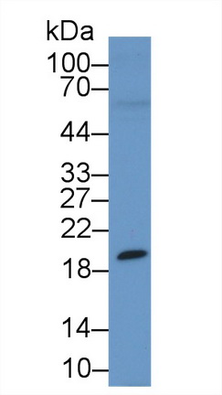 Polyclonal Antibody to Hexosaminidase A Alpha (HEXa)