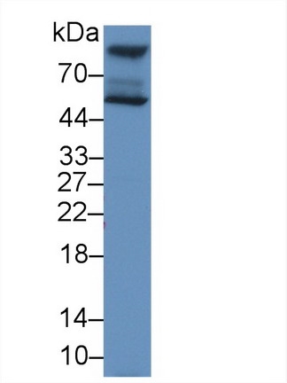 Polyclonal Antibody to Hexosaminidase A Alpha (HEXa)