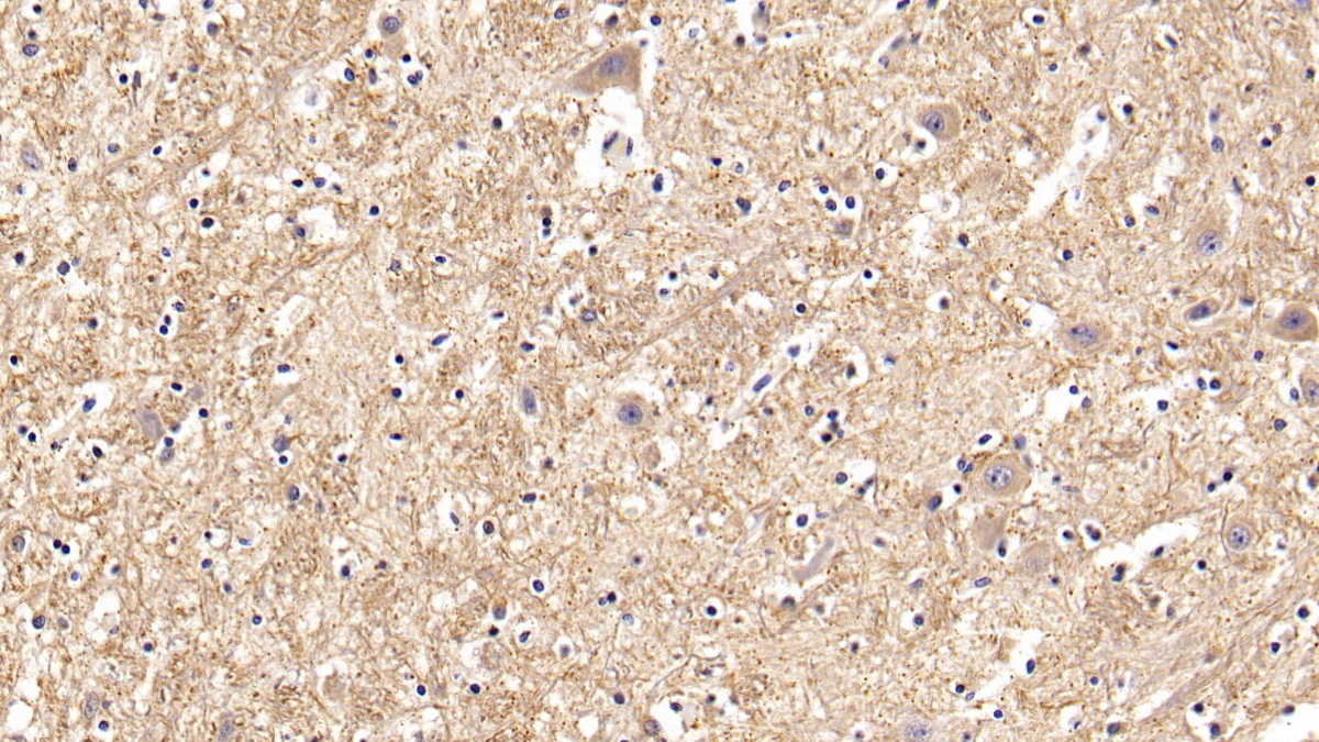 Polyclonal Antibody to Galactosidase Beta (GLb)