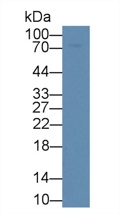 Polyclonal Antibody to Galactosidase Beta (GLb)