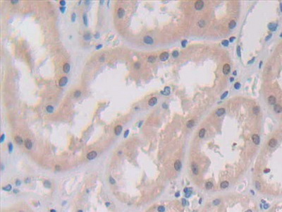 Polyclonal Antibody to Ribonuclease P (RNASEP)