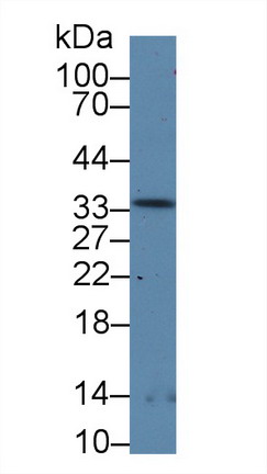 Polyclonal Antibody to Ribonuclease P (RNASEP)