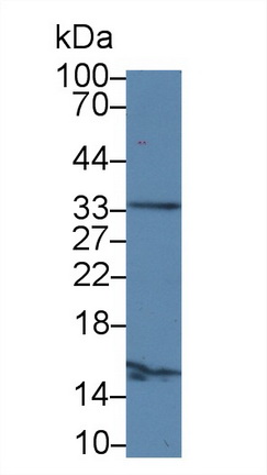 Polyclonal Antibody to Ribonuclease P (RNASEP)