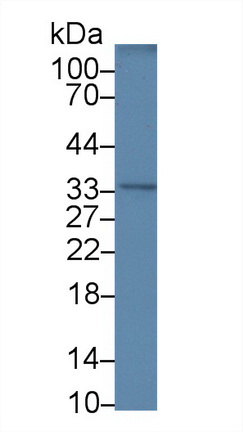 Polyclonal Antibody to Ribonuclease P (RNASEP)