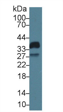 Polyclonal Antibody to Growth Arrest Specific Protein 2 (GAS2)