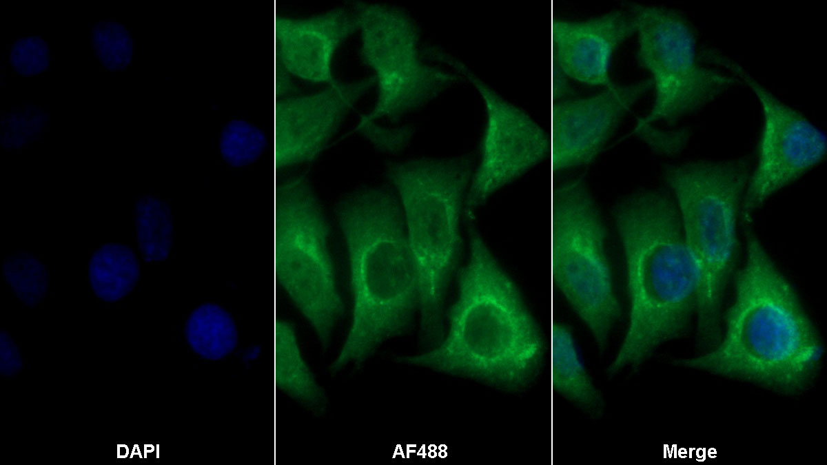 Polyclonal Antibody to Growth Arrest Specific Protein 6 (GAS6)