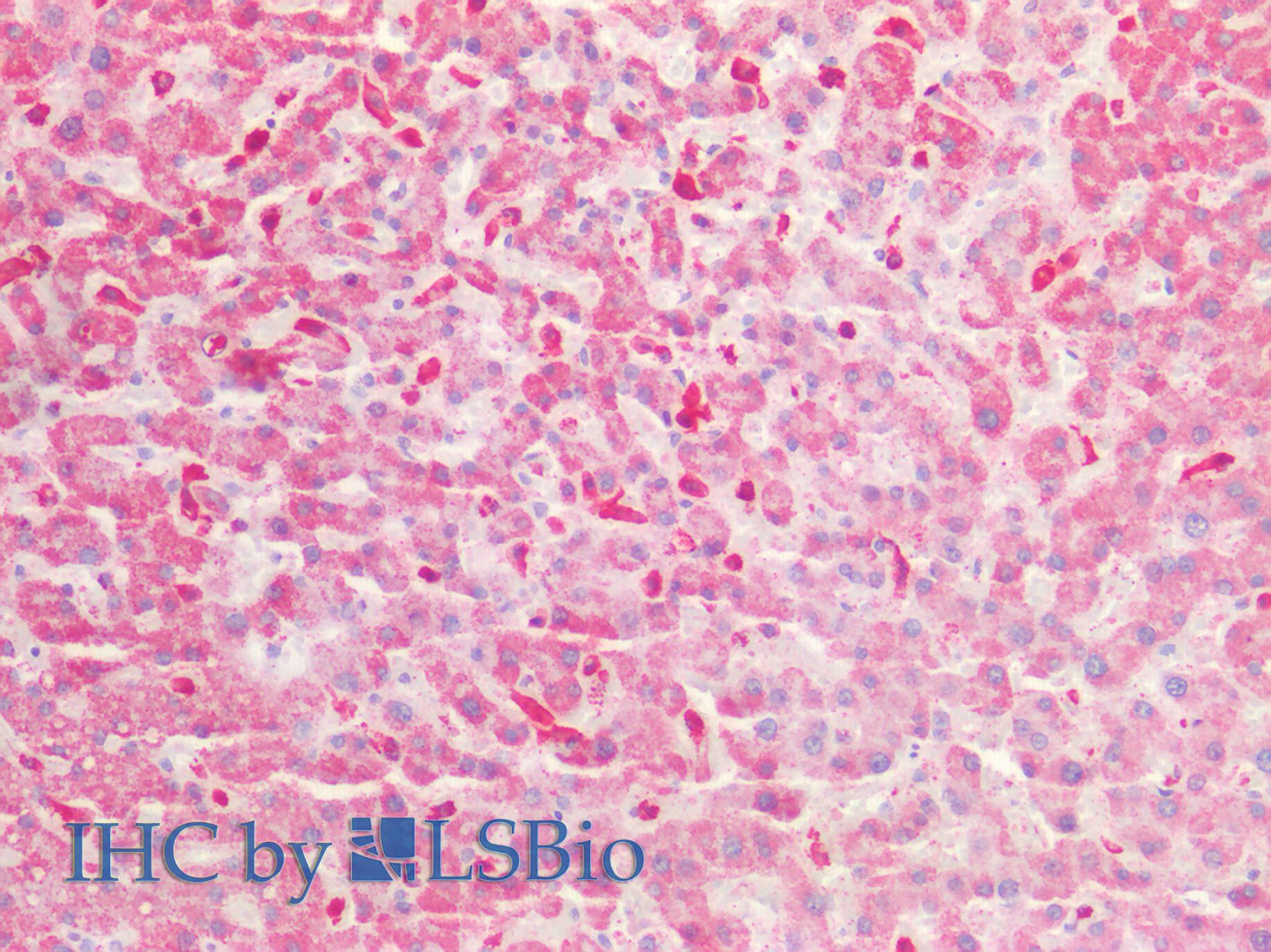 Polyclonal Antibody to Growth Arrest Specific Protein 6 (GAS6)