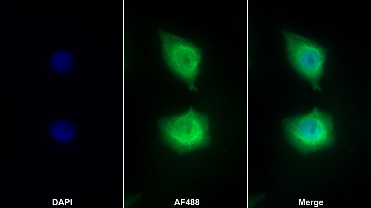 Polyclonal Antibody to Growth Arrest Specific Protein 6 (GAS6)