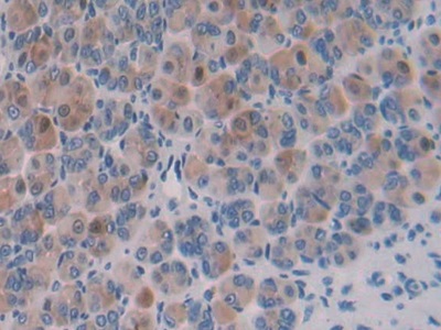 Polyclonal Antibody to Importin 8 (IPO8)