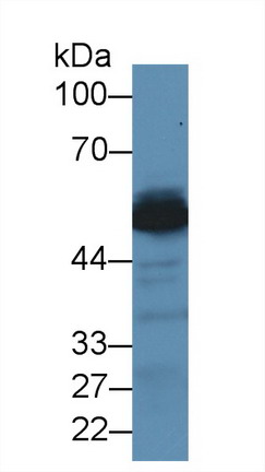 Polyclonal Antibody to Alanine Aminotransferase (ALT)