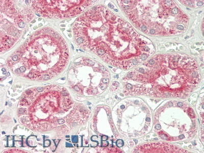 Polyclonal Antibody to Alanine Aminotransferase (ALT)