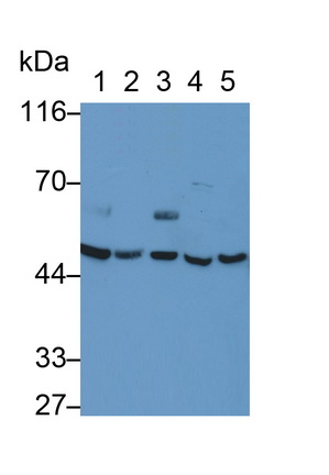 Polyclonal Antibody to Alanine Aminotransferase (ALT)