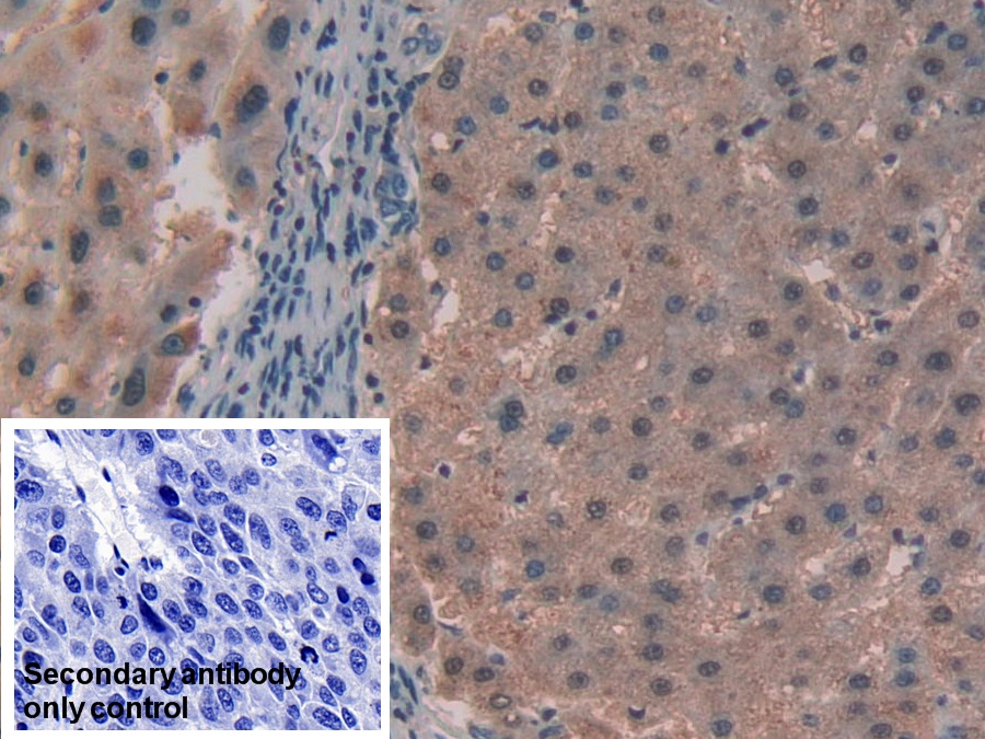 Polyclonal Antibody to Alanine Aminotransferase (ALT)