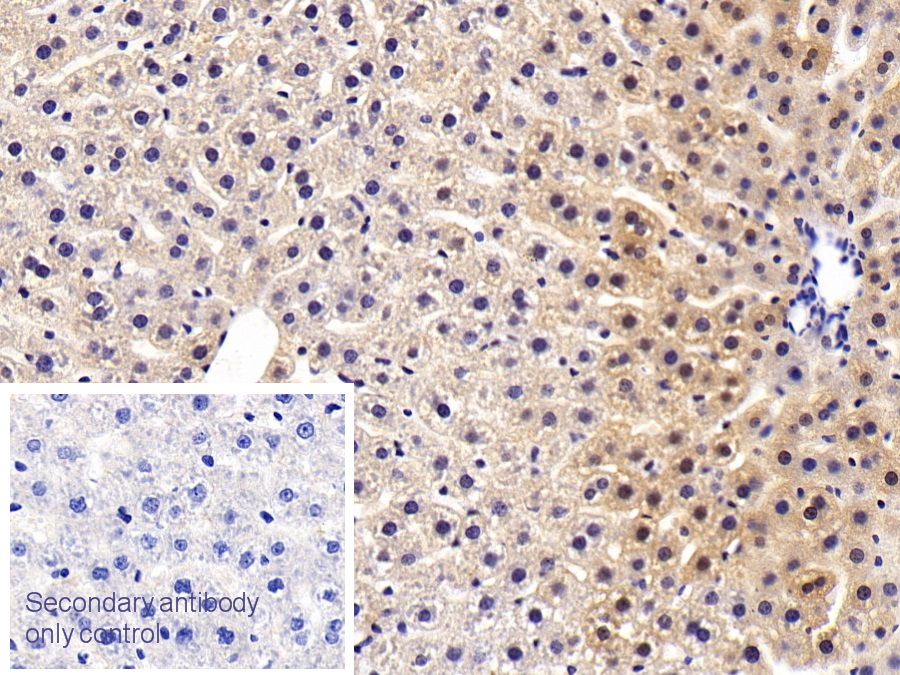 Polyclonal Antibody to Alanine Aminotransferase (ALT)