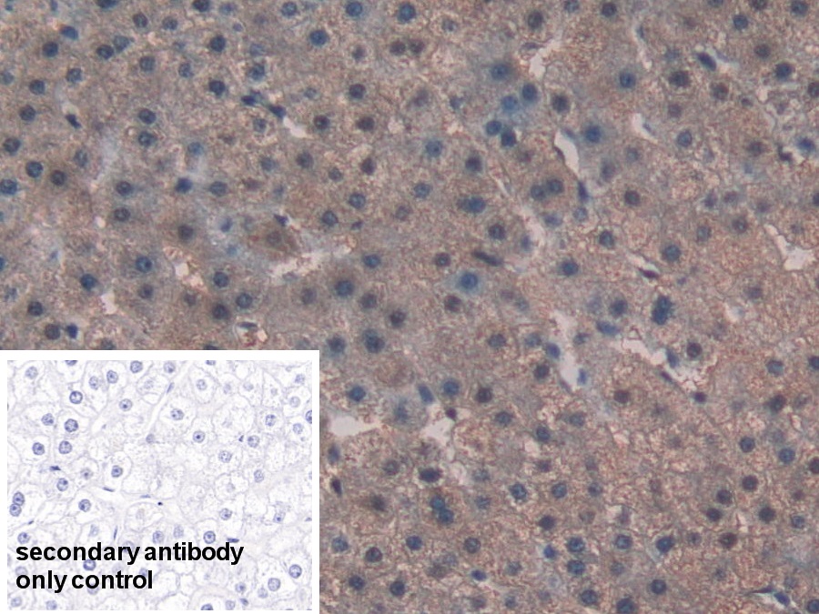 Polyclonal Antibody to Alanine Aminotransferase (ALT)